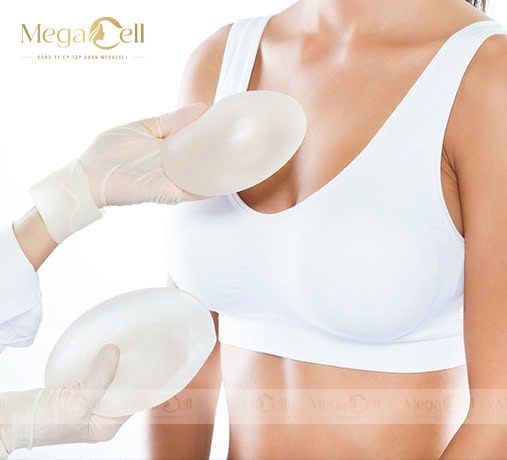 Cần Lưu Ý Gì Khi Nâng Ngực Để Tốt Cho Phong Thủy