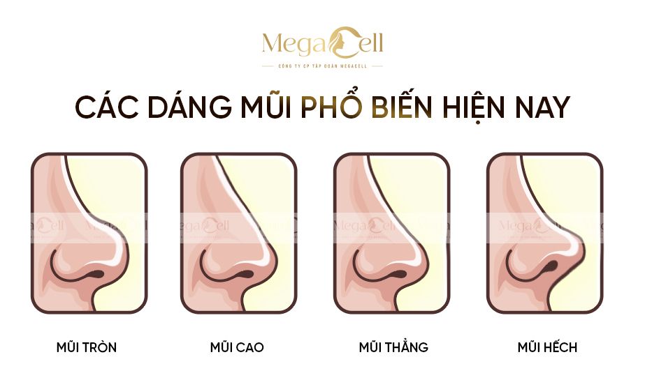 Nâng Mũi Phong Thủy Là Gì?