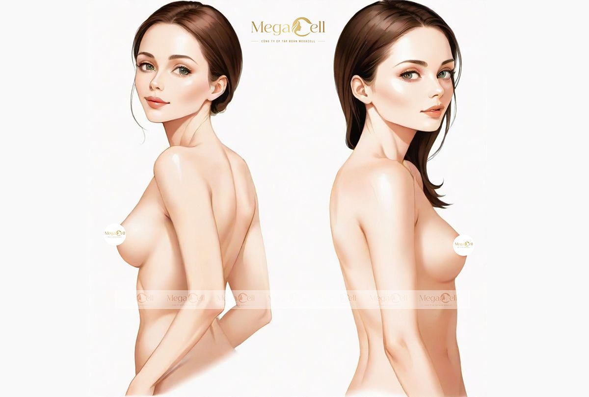 Cần Lưu Ý Gì Khi Nâng Ngực Để Tốt Cho Phong Thủy