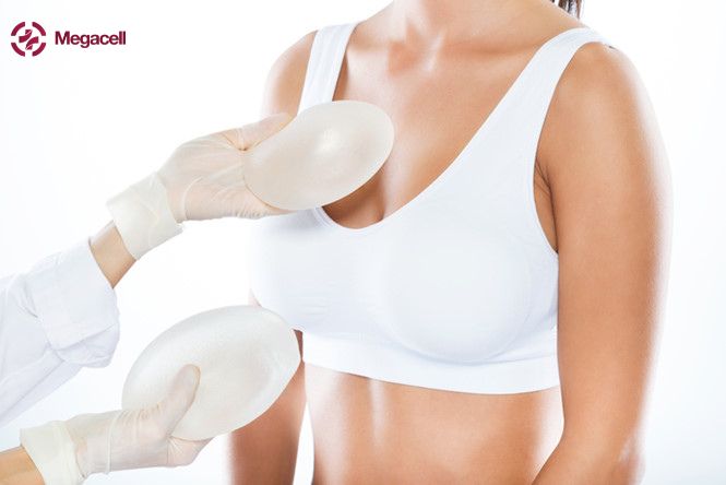 Nâng ngực có nguy hiểm không, được bao nhiêu năm?