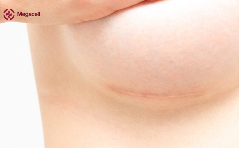 Lưu bản nháp tự động