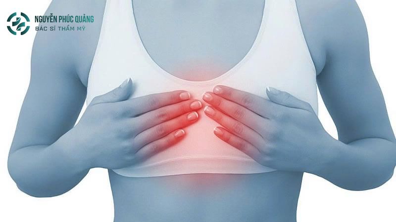 Nâng ngực có nguy hiểm không, được bao nhiêu năm?