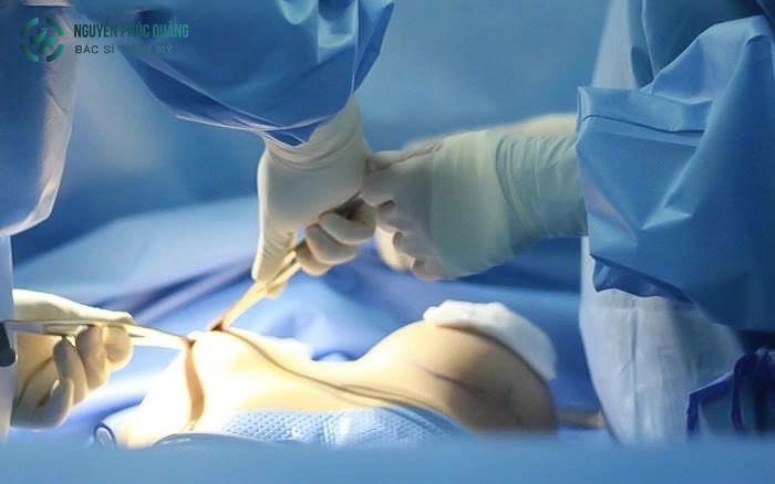 Nâng ngực có nguy hiểm không, được bao nhiêu năm?